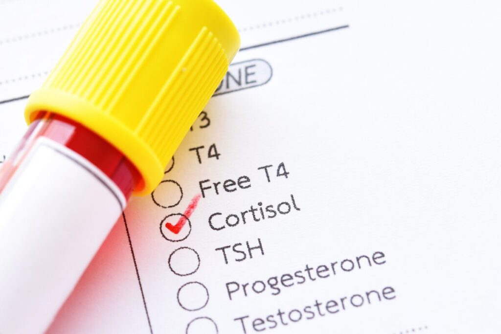 Hormone test with cortisol checked off.